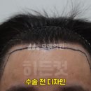 모엠의원 이미지