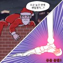 종골골절 통증과 일반상해보험 장해 청구방법 이미지