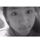 히잇 이미지