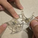 세명피아노학원 | 초2 성장교정/소아교정 5개월차 진행상황