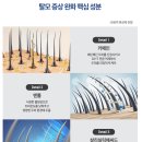피에스솔루션 | [두피 토닉 추천] 탈모 완화와 두피 진정을 동시에, 스캘프 솔루션 토닉 후기 및 사용법