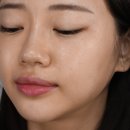팔자주름리프팅후기 후 관리 안했다가 돈 날릴뻔