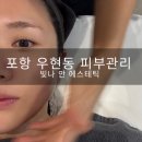 늘빛나에스테틱 | 포항 우현동 1:1 피부 맞춤형 컨설팅 우주인토닝 후기_빛나 안 에스테틱