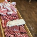 백산1킬로그램식육식당 | 자궁내막증 난소 낭종 절제술 후기 (2) : 입원과 수술
