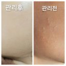 오늘은밝은피부 이미지