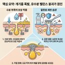 유화지질(주) - 밀양시 삼문동 | 피지 과다 분비, 딱 2주 만에 얼굴 개기름 반으로 줄인 스킨케어 루틴