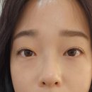 올데이래쉬 이미지