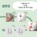 동호한의원 | [교대역피부과] 윤앤송한의원 여드름흉터 치료1차(미침) / 2차(윤침) 후기