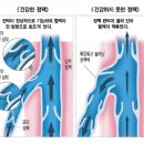 자주 붓는 내 다리, 단순히 피곤해서일까? 이미지