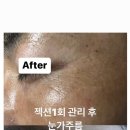 로운에스테틱