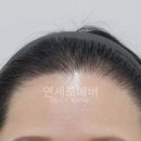 연세모에버의원 이미지