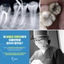 서울이튼치과 이미지