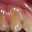 이(e)-밝은치과의원 이미지