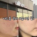 4192 | 턱좁쌀여드름 관리! 창원에스테틱 유일한에스테틱 피부관리 후기