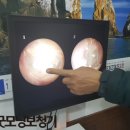 영주보청기 | [영주보청기/봉화보청기] 63세 어머님 보청기 후기