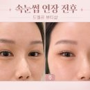 전속눈썹연장 드엘르눈썹&속눈썹 자연스러운 속눈썹연장 후기