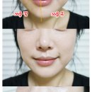 비비천사 이미지