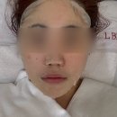 유일메디칼 | [판교] 판교역 에스테틱 피부컨설팅부터 제대로 해주는 엘부티끄!!(솔직후기ㅇ)