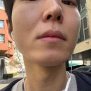 삼성동-14 | 삼성동남자제모 삼성역남자제모 실킨제모 14회차 15회차 후기