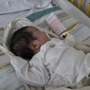 강원대학교병원 | 강원대학교병원 신생아 유문협착증 수술후기