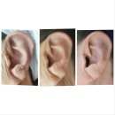 오늘더맑음의원 | 향동 에스테틱ㅣ더 맑음 피부 연구소