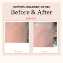 당근약국 | 🌸 기미가 옅어지는 찐 후기✨ 자색당근세럼 56일의 변화!