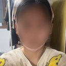약손명가 리프팅밴드 꿀팁 + 내돈내산 찐후기 (전/후 사진 ㅇ)