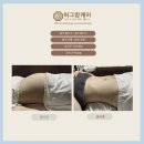단지장골1 | 쌍생아 제왕절개 분만 출산 후 출장산후마사지 가슴관리 양천구 마포구 영등포구 서초구 용산구 산후...