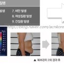 노바의료기 이미지