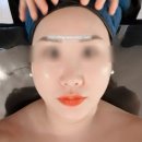 4471 | 충남 천안 두정동 에버림 MTS 받은 리얼 후기