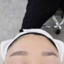 춘천에스테틱 플라즈마화이트태닝 리얼후기 더맑은스킨 춘천퇴계점