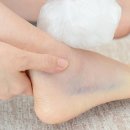 보조기전