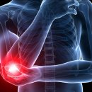 봄꽃한의원 이미지