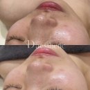 해운대 센텀 피부관리 피부장벽공사로 피부를 튼튼하게 해보세요!