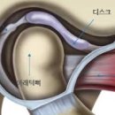 턱관절장애 증상 턱통증 턱소리 원인 이미지