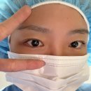 김만수 | 느낌표안과 여기서 안경생활 16년차 청산한다 김만수안과 라섹 2주차 후기