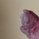 동강의료기 | 매복 사랑니 발치 후기