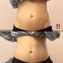 비다 | 신림복부관리 웨딩관리 촬영 전 다이어트 비다에스테 후기