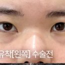 리미트성형외과의원