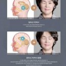 엄마손한의원 네이버블로그