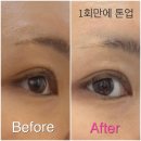 서산 피부경락 피부관리 [피부아지트뉴페이스] 솔직후기 전후사진