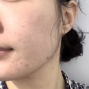 [다이소] 미모 바이 마몽드 피어니 티놀 모공 앰플 추천 솔직 후기