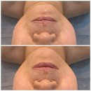 씨유대전유천스타점 | 대전 에스테틱 추천, 212네일뷰티&amp;푸스대전유천점 관리 후기