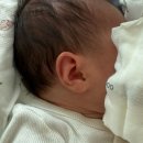 웰메드 | 신생아 귀접힘, 셀프 귀교정 후기 (스테리스트립 사용)