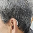 화명독일보청기 이미지