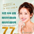 거미스마일 후기, 웃을 때 잇몸이 많이 보인다면? 매직키스치과에서 확인해보세요
