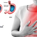 더바른교정운동센터 이미지
