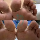 미르뷰티아카데미 | 대구발각질 남다른 관리 실력 바이오뷰티네일