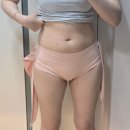 불당하나의원 | 365mc의원 천안점│허벅지, 승마살, 뱃살 람스 받고 온 후기(당일 차)