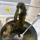 11260-2-37-10 | 임신 37주 수원덕산병원에서 양수과소증으로 응급 제왕절개한 주절주절 생생 후기 !